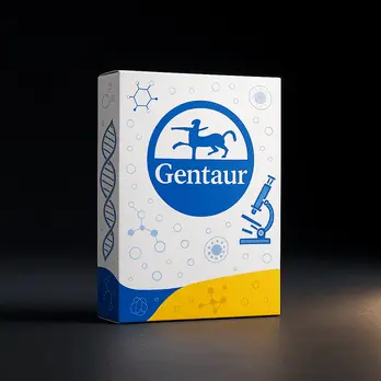 Helicobacter pylori IgG plus